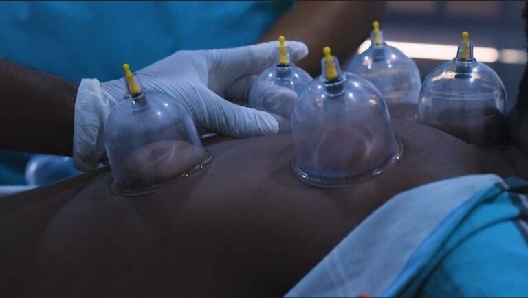 Almonan Hijama Academy