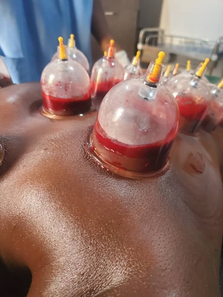 Almonan Hijama Academy