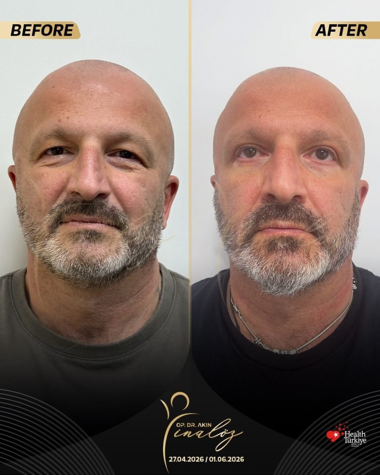 Op. Dr. Akın İnalöz