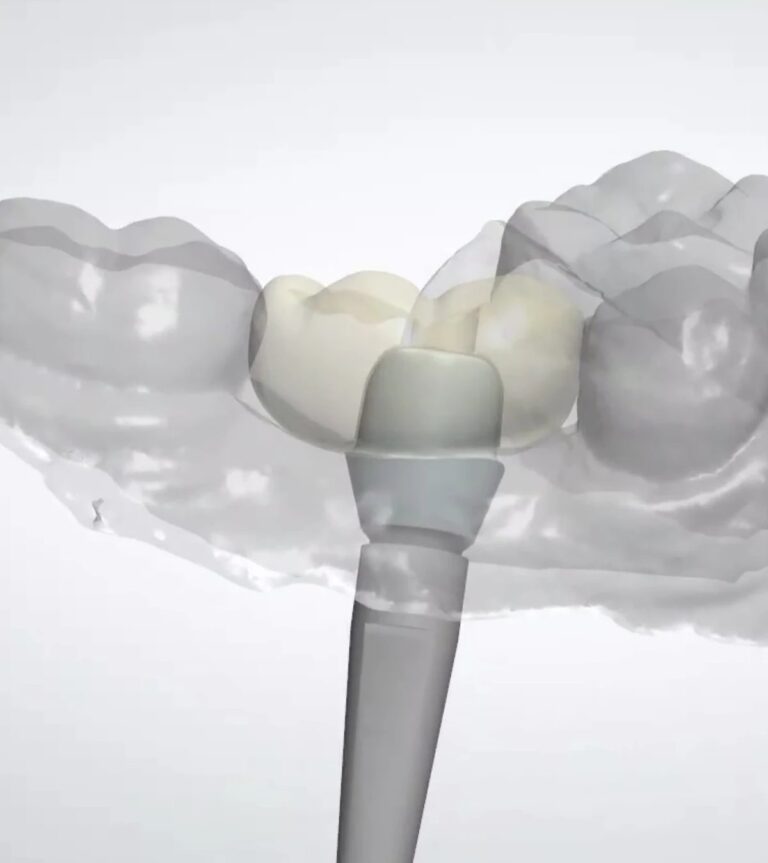 Pristine Dental Design